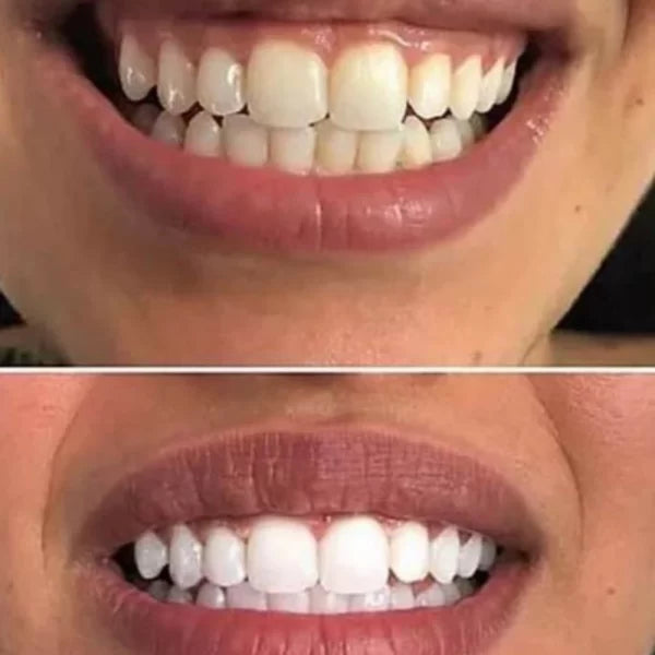 Crest 3D White Expert Whitening