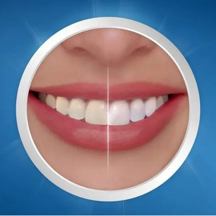Crest 3D Whitestrips Professional Effects – Blanchiment Dentaire
