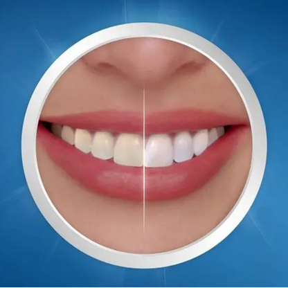 Crest 3D Whitestrips Professional Effects – Blanchiment Dentaire