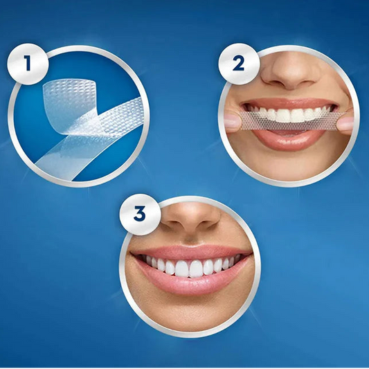 Crest 3D Whitestrips Glammourous Effects – Blanchiment Dentaire